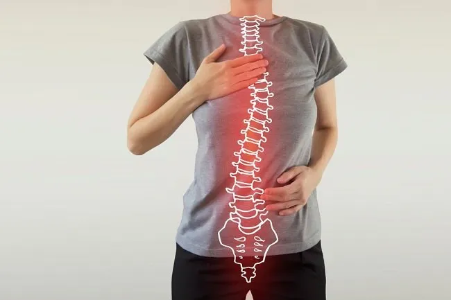skoliosis pada remaja